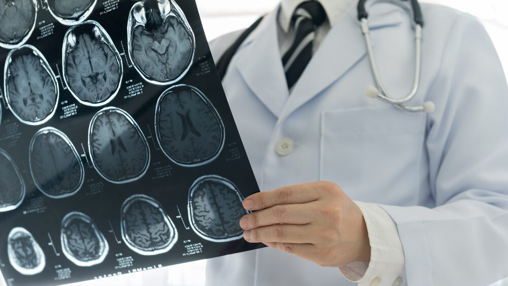 Understanding Traumatic Brain Injuries: A Comprehensive Guide to Pennsylvania Laws and Compensation